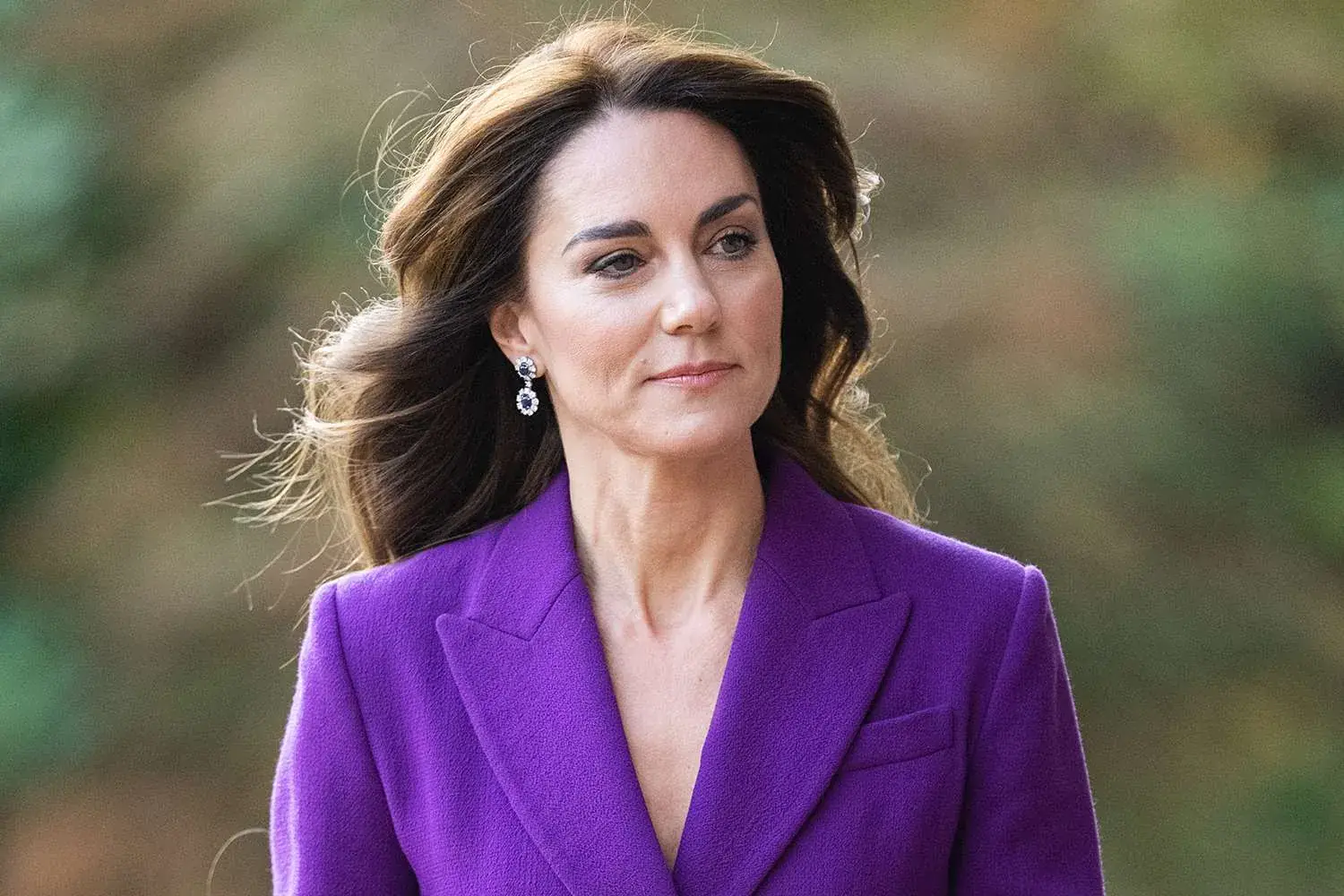 Kate Middleton reveals cancer diagnosis, has begun chemotherapy Illustrations